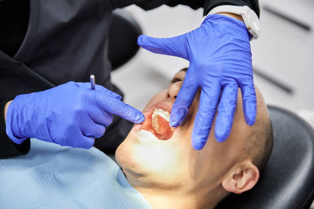 Best Emergency Treatment for Dental Infections or Abscesses in Ossun, LA